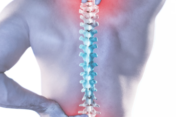 Kineziterapija esant ūmiam ar lėtiniam nugaros skausmui